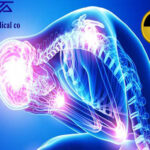 X-Rays radiation effects on human body