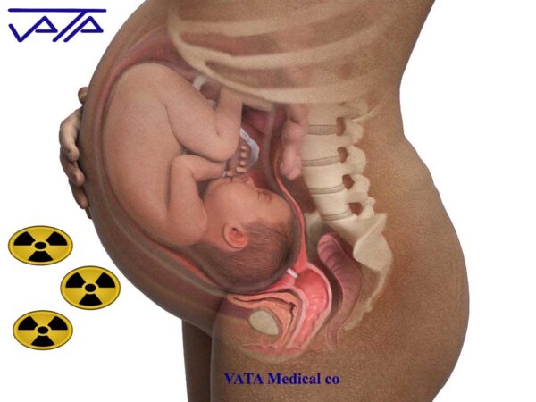 x-ray radiation risks and pregnancy