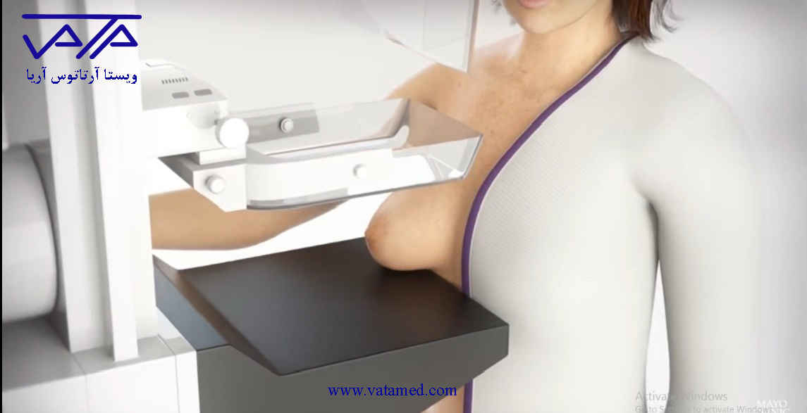 اهمیت ماموگرافی در تشخیص سرطان پستان